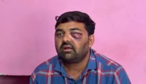 BIG BREAKING | SSP के बंद कमरे में डेढ़ घंटे तक भयावह यातना का आरोप